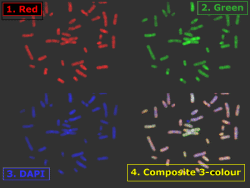 CGH metaphase image capture; click to enlarge (22K)
