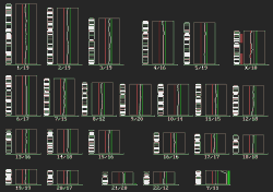 Ideogram: normal DNA; click to enlarge (20K)