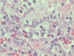 Lymph node section; click to enlarge (34K)