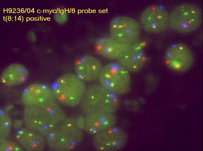 Dual Fusion Translocation Assay