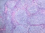 Follicular morphology; click to enlarge (65K)
