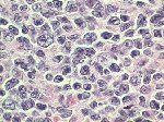 Small cell morphology; click to enlarge (57K)