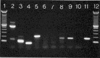 bcl-2/IgH PCR gel; click to enlarge (24K)