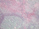 Lymph node section; click to enlarge (52K)