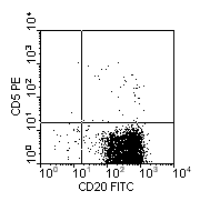 CD20-FITC vs CD5-PE; click to enlarge (3K)