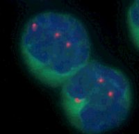 FISH: Trisomy 3; click to enlarge (20K)
