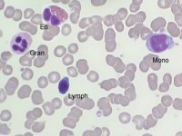 Normal peripheral blood morphology; click to enlarge (26K)