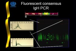 Fluorescent IgH PCR strategy; click to enlarge (24K)